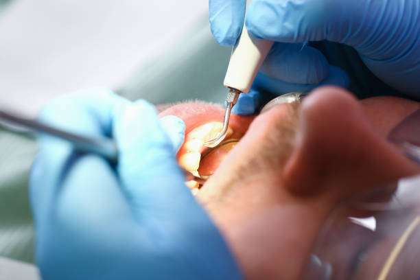 Best Weekend Emergency Dental Services in Wakarusa, IN