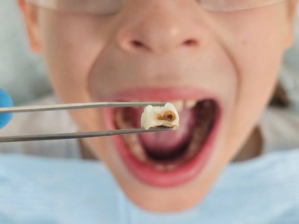 Best Emergency Pediatric Dental Care in Wakarusa, IN